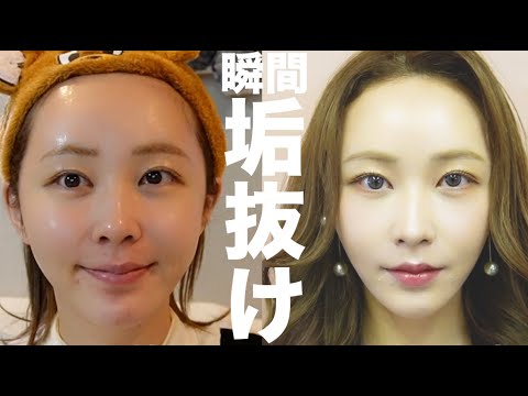 てんちむの歯の整形が話題!韓国施術の真相と賛否両論の口コミを徹底解説